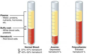 Three tubes of centrifuged blood. This shows the differences in normal, anemic, and polycythemic blood.