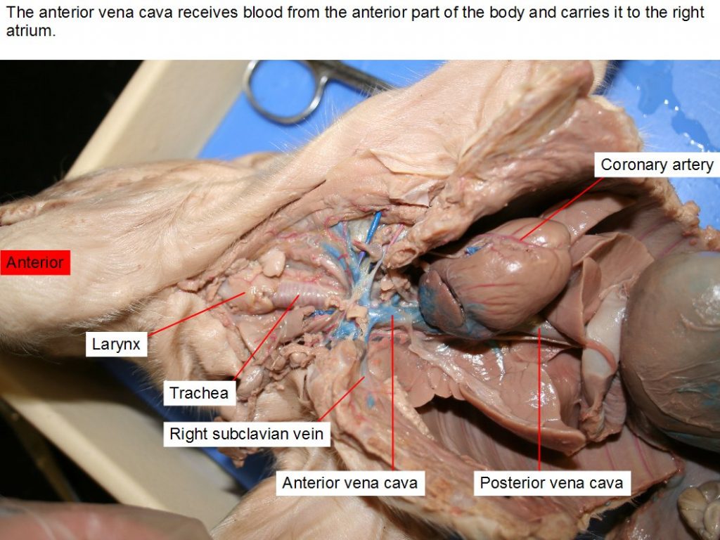 Aortic arch, left atrium, brachiocephalic artery, left common carotid artery, right common carotid artery, larynx, pulmonary trunk, left subclavian artery, right subclavian artery, left ventricle.