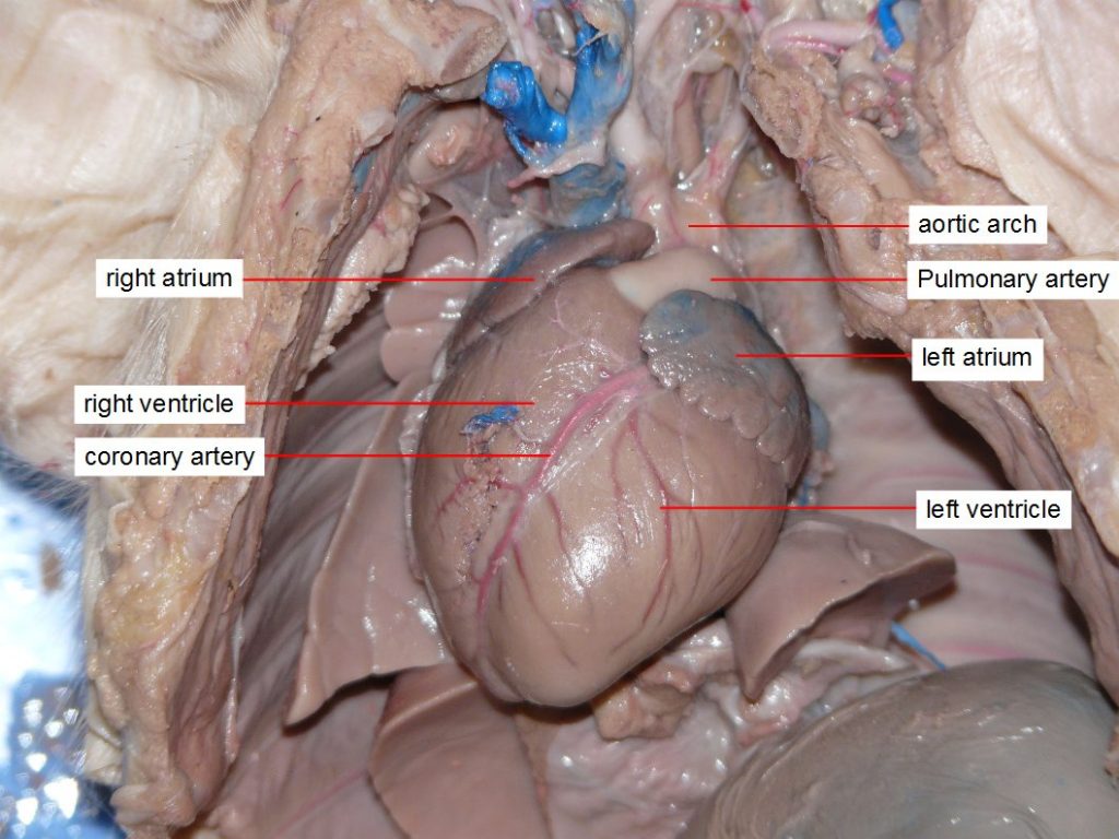 Aortic arch, coronary artery, left atrium, left ventricle, pulmonary artery, right atrium, right ventricle.
