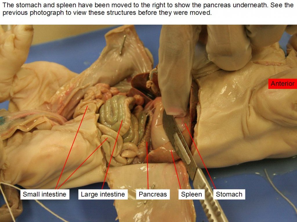 Small intestine, large intestine, pancreas, spleen, stomach. The spleen has been moved aside the reveal the pancreas.