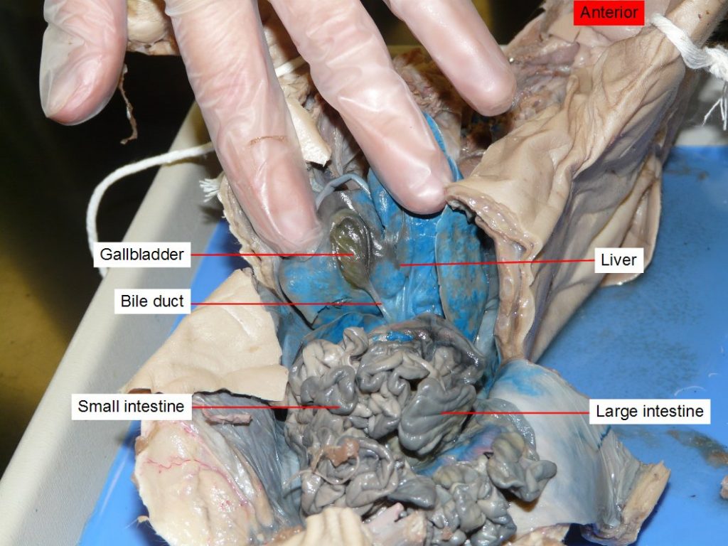 Bile duct, gallbladder, large intestine, liver, small intestine. the liver has been lifted to reveal the gallbladder.