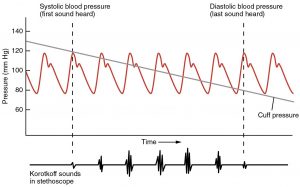 Blood pressure measurement with Korotkoff sounds.
