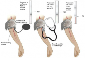 Blood pressure measurement of 120/70. Placement of stethoscope and cuff.