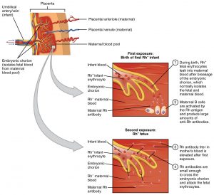 Visualizing fetal hemolysis at the level of the placenta.