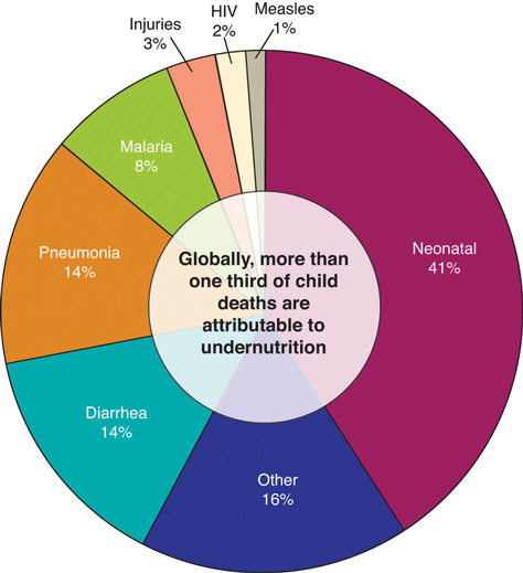 Pie graph of the causes of death for children. Globally, more than one third of child deaths are attributable to undernutrition. 14% Neonatal, 165 Other, 14% Diarrhea, 14% Pneumonia, 8% Malaria, 3% Injuries, 2% HIV, 1% Measles.