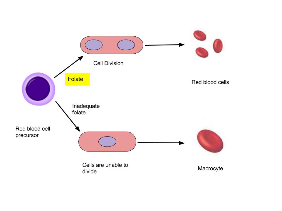 Folate and the Formation of Macrocytic Anemia
