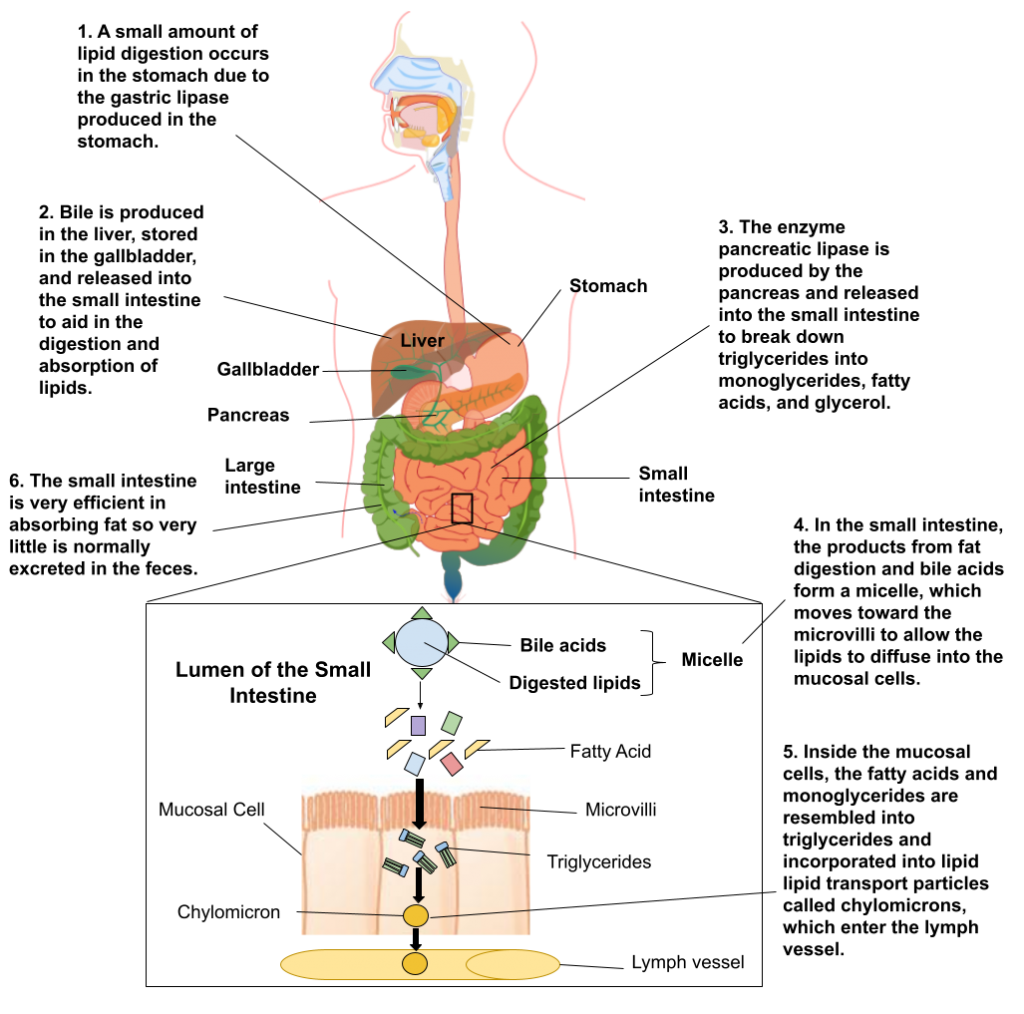 Illustrated diagram of human body showing lipid digestion and absorption. 1. Small amount of lipid digestion occurs in stomach due to gastric lipase produced in stomach 2. Bile produced in liver, stored in gallbladder, release into small intestine to aid digestion and absorption of lipids. 3. Pancreatic lipase produced by pancreas and released into small intestine to break down triglycerides, fatty acids, and glycerol. 4. In small intestine products from fat digestion and bile acids form micelle, which moves towrad the microvilli allowing lipids to diffuse into mucosal cells. 5. Inside mucuosal cell, fatty acids and monoglycerides reassembled into triglycerides and incorporated into lipids transport particles called chylomicrons, which enter the lymph vessel.