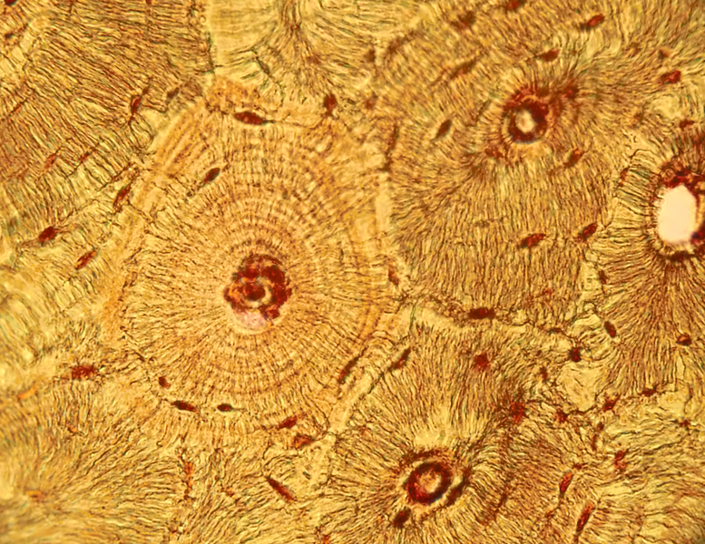 micrograph of compact bone with osteons